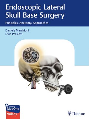 cover image of Endoscopic Lateral Skull Base Surgery